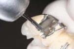 TriHawk Einmal-Bohrer starteten bereits vor 50 Jahren mit einer Vision