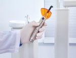 Individuelle Polymerisationsprotokolle für langlebige Füllungen